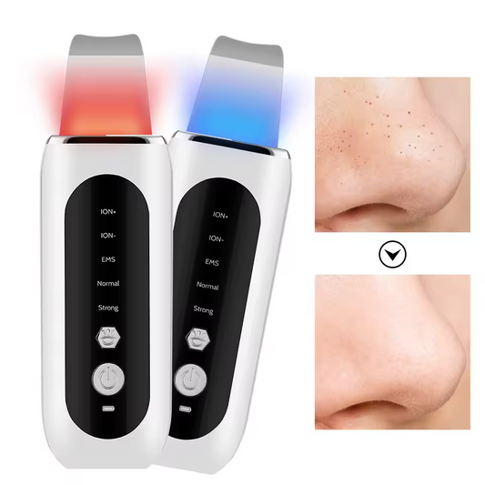 Ultrasonic Face Skin Scrubber Vibration Nose Deep Cleaning Machine